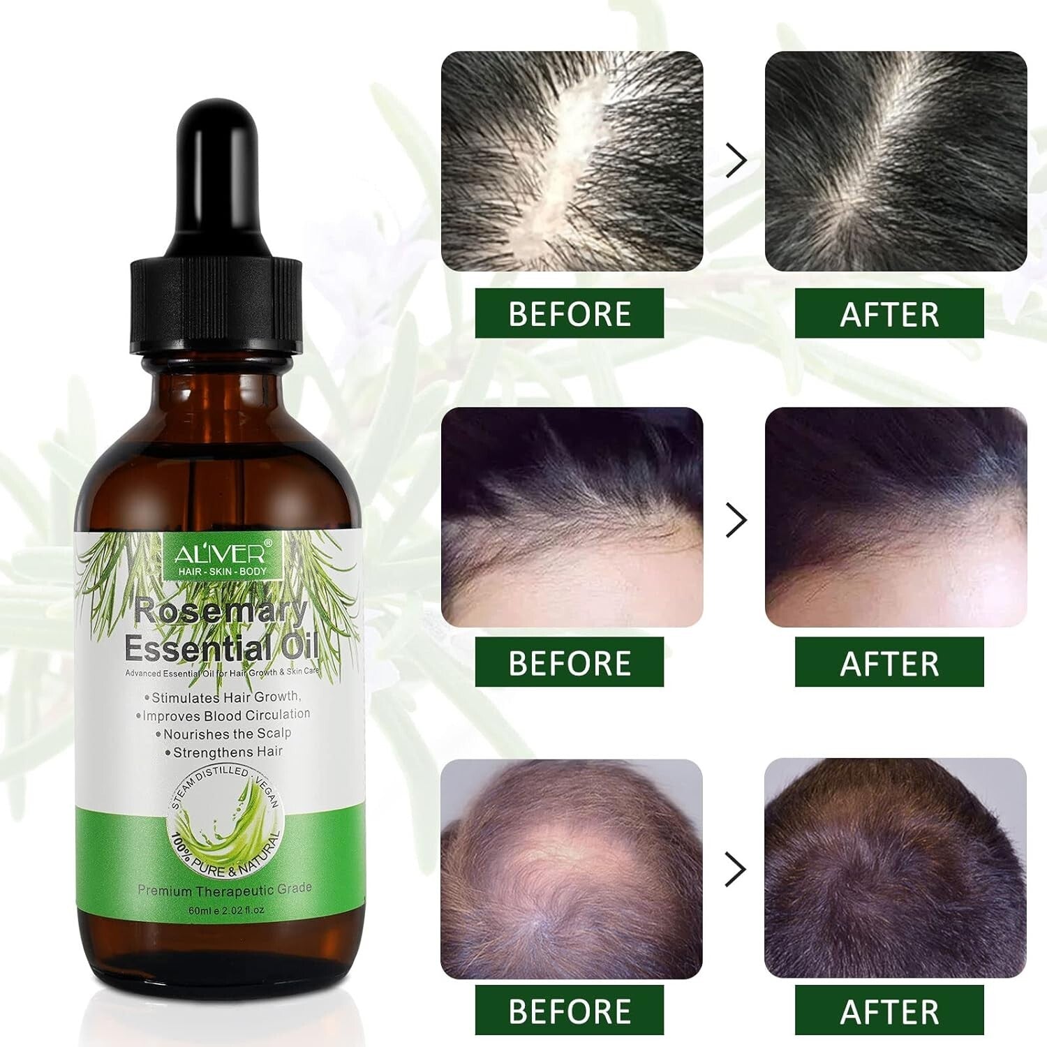 Rosemary Essential Oil for Hair Growth - 100% Pure and Natural, Ideal for Aromatherapy